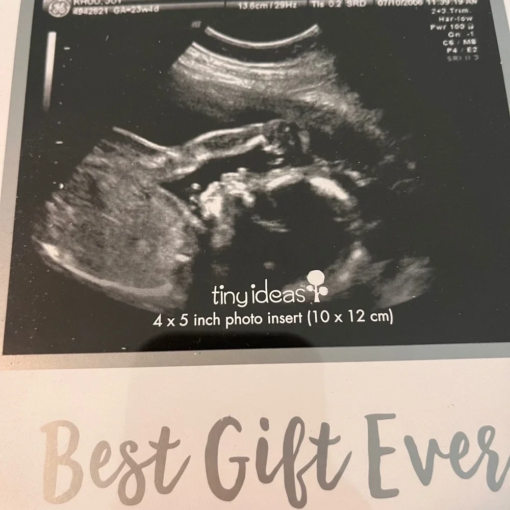Tiny Ideas Sonogram Signature Frame White Baby Ultrasound Keepsake with Marker